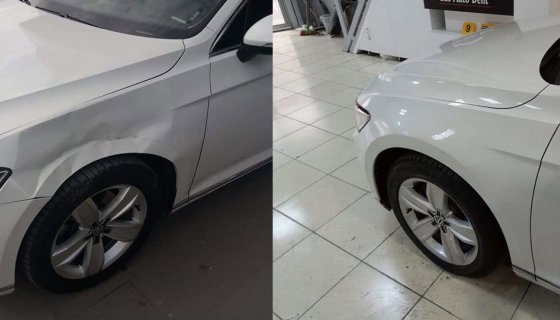 Boyasız Göçük Düzeltme